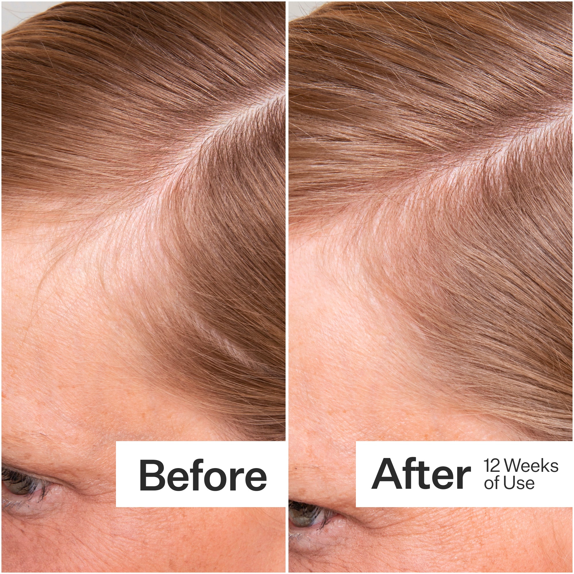 Side-by-side comparison of hair before and after 12 weeks of use, showing noticeable improvement in thickness and volume.