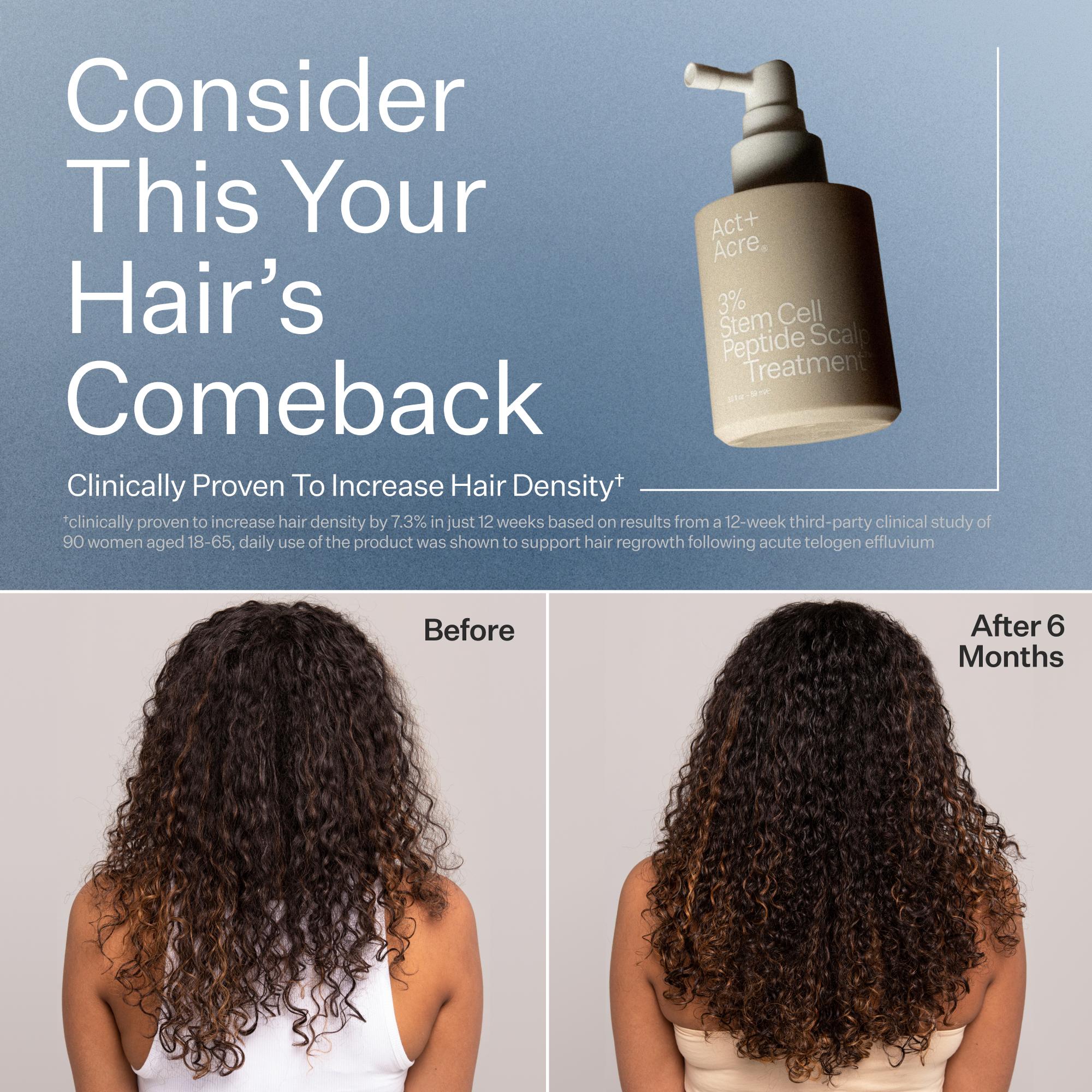 Hair treatment product with 'Before' and 'After' results showing increased hair density.
