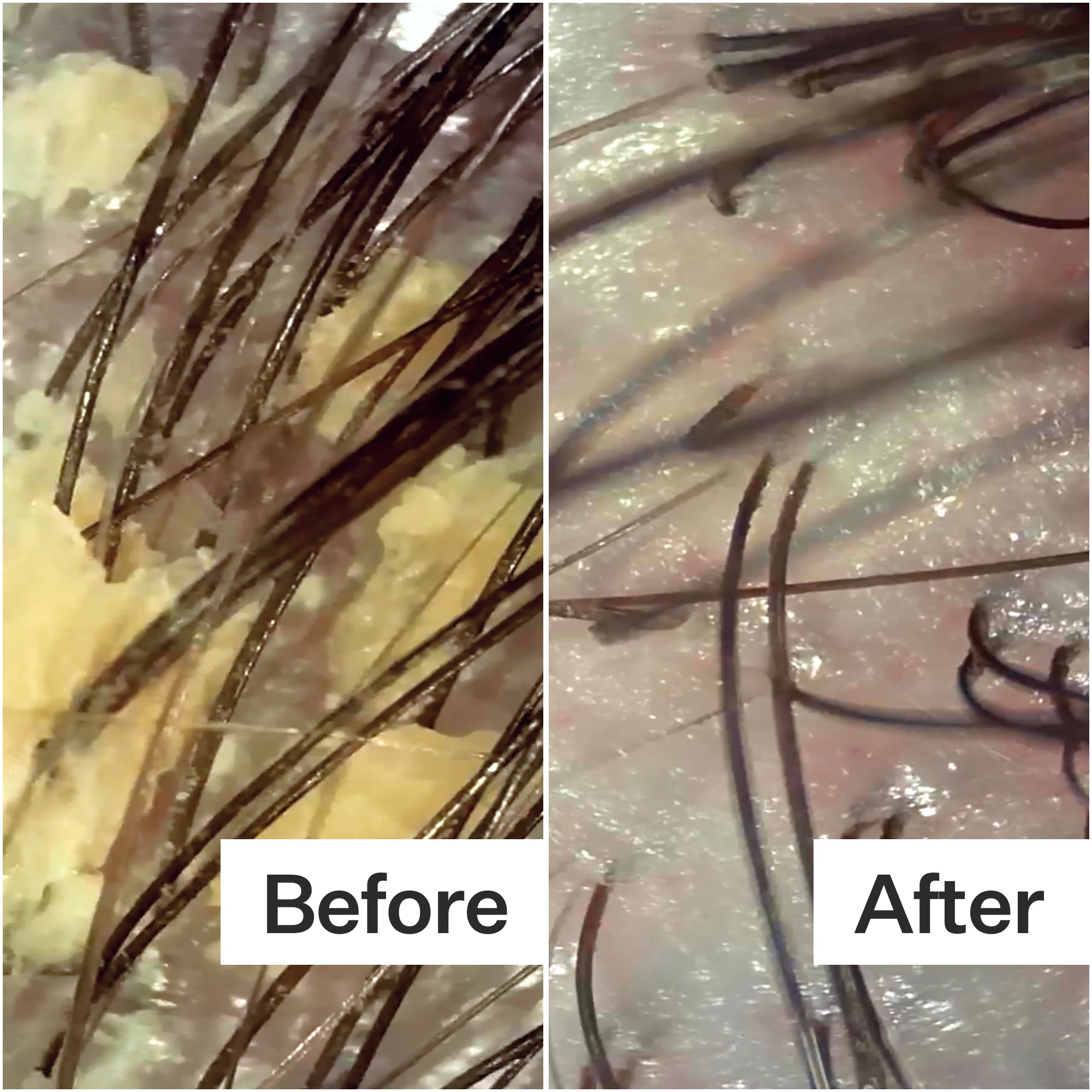 A split image showing a close-up of hair and scalp. The left side is messy with buildup, while the right side appears clean and clear.
