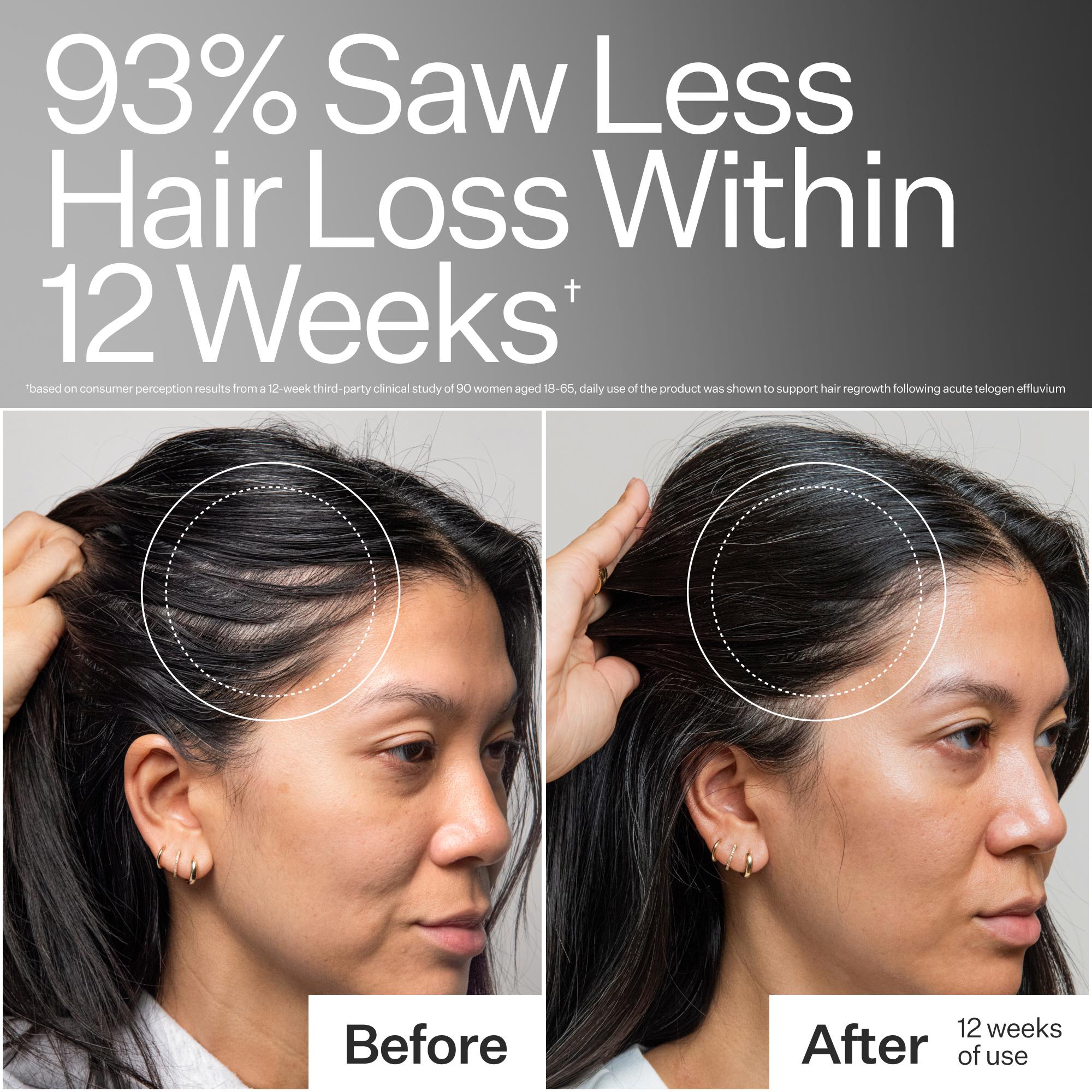 Before and after comparison of hair loss reduction with text indicating 93% saw less hair loss within 12 weeks.