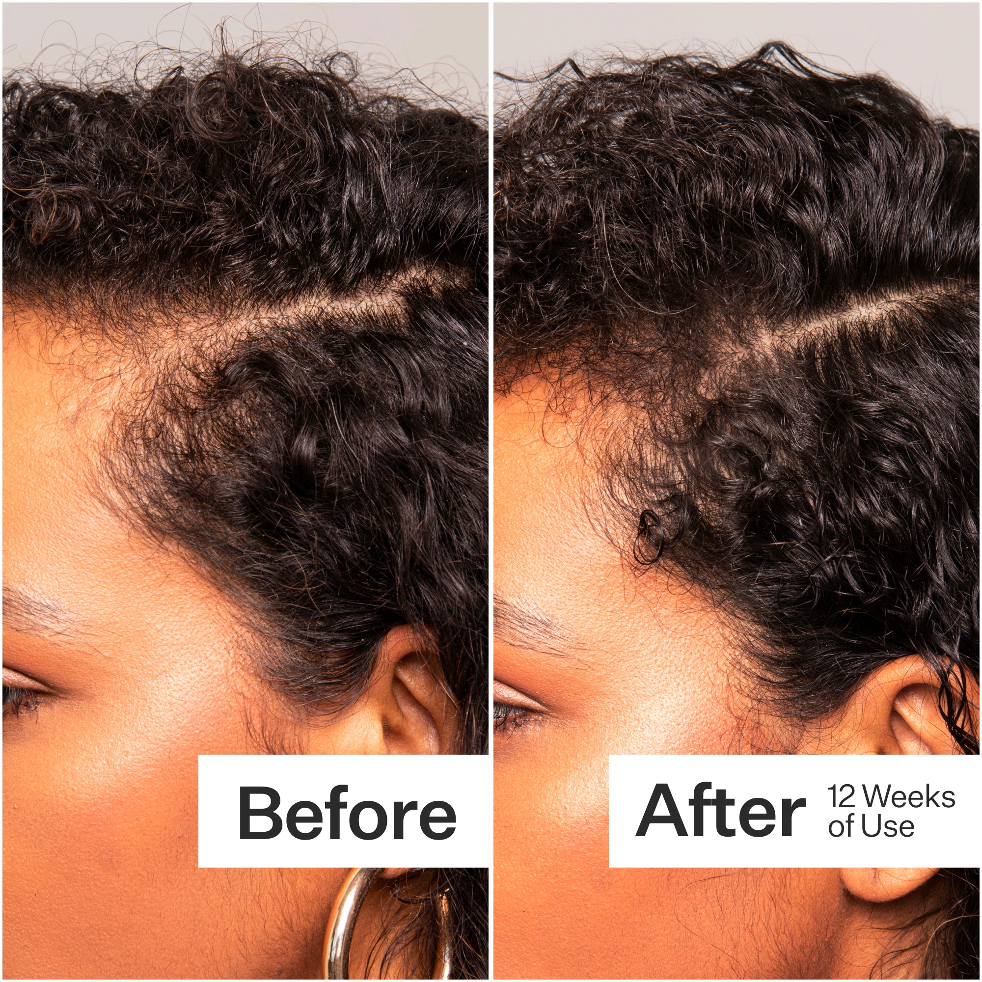 Side-by-side comparison of hair before and after 12 weeks of use, showing improved curl definition and volume.