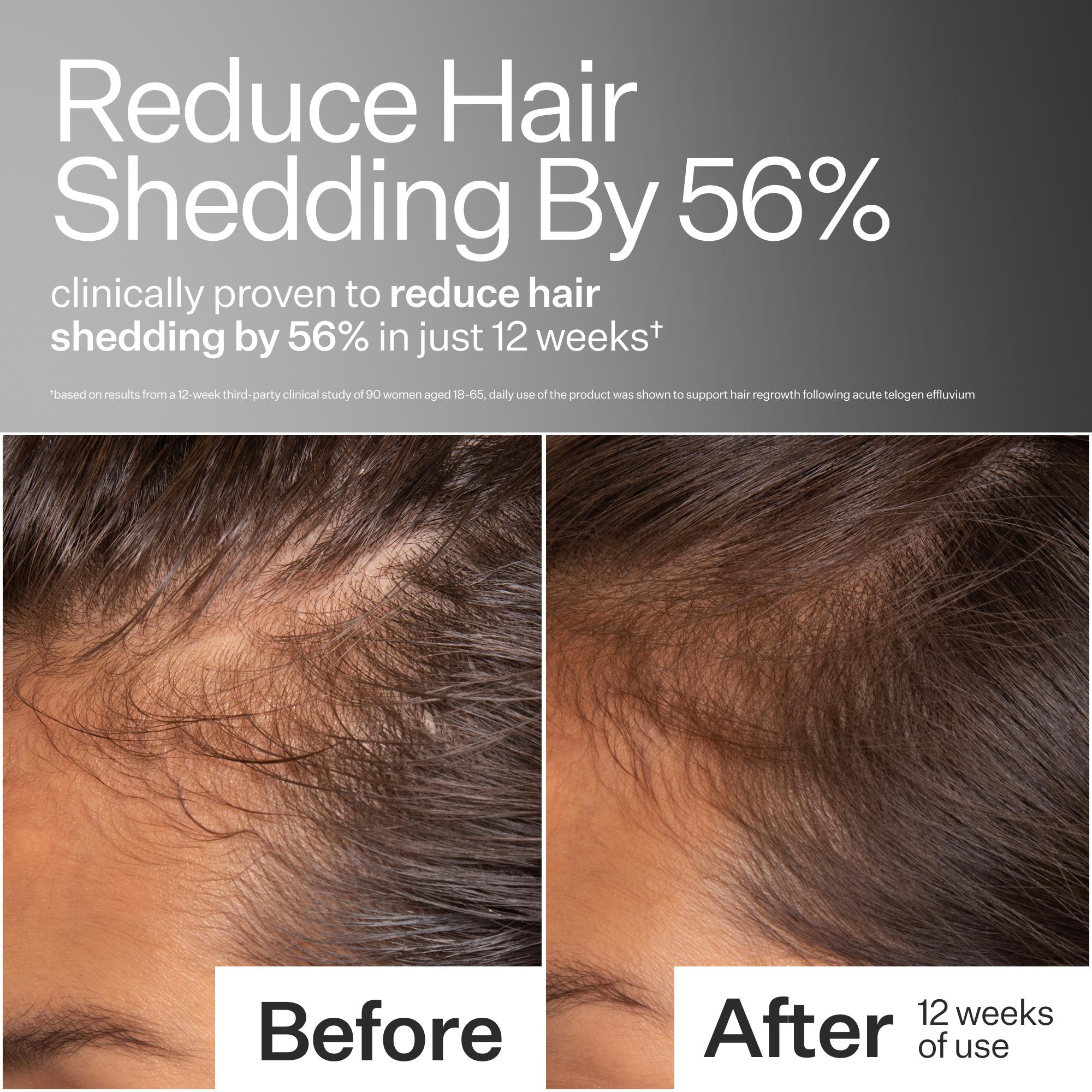 Before and after comparison of hair shedding reduction with text indicating 56% reduction in just 12 weeks.