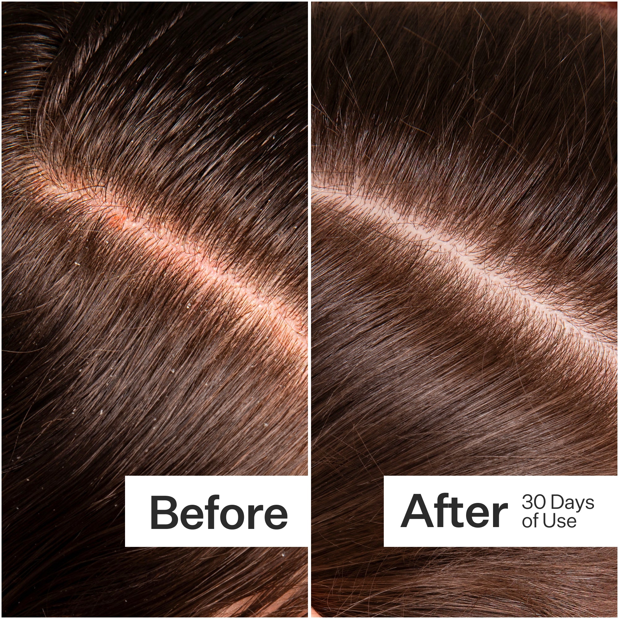Side-by-side comparison of hair before and after 30 days of use, showing improved shine and reduced flakes.