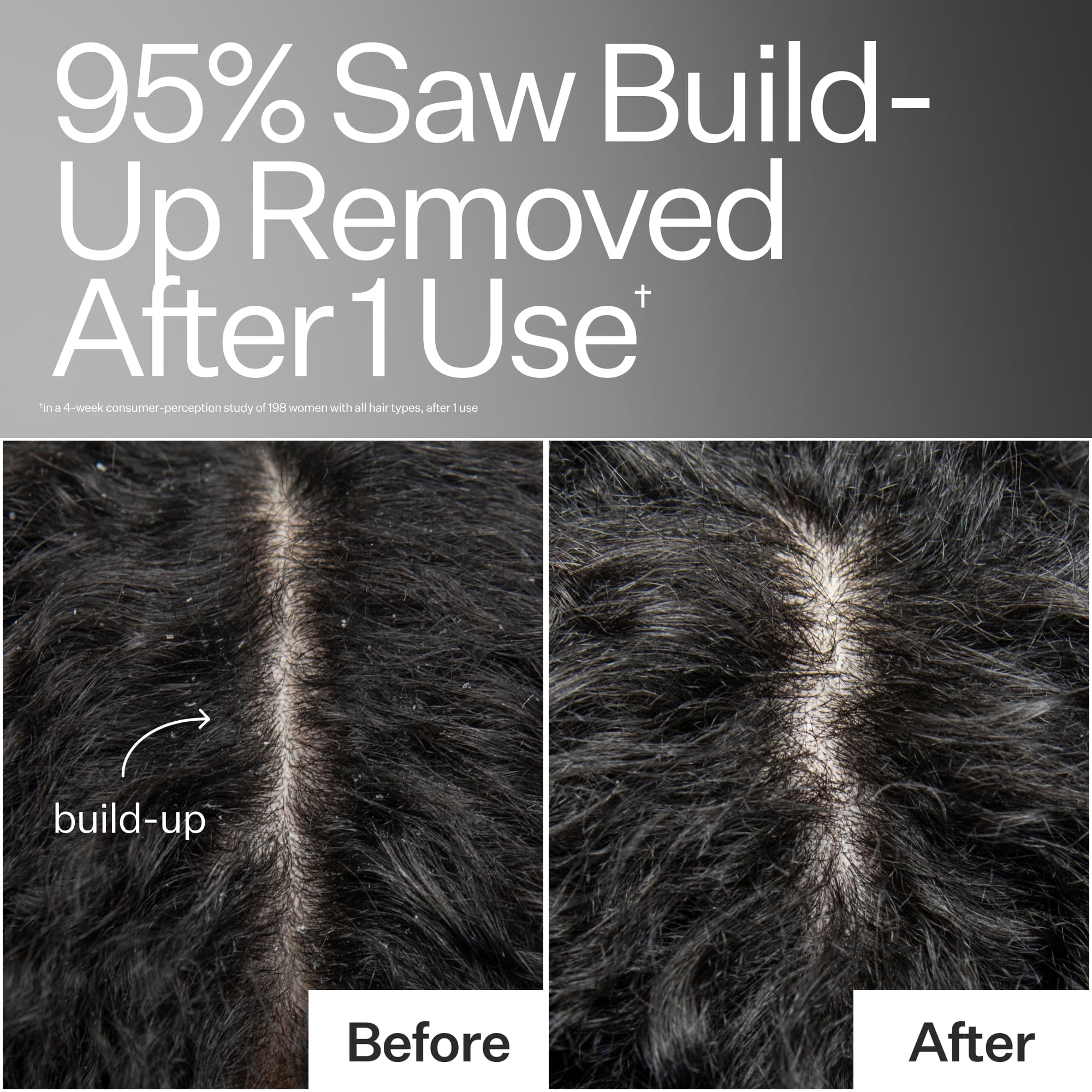 Before/After of scalp when using Act+Acre Vitamin E Scalp Detox Oil