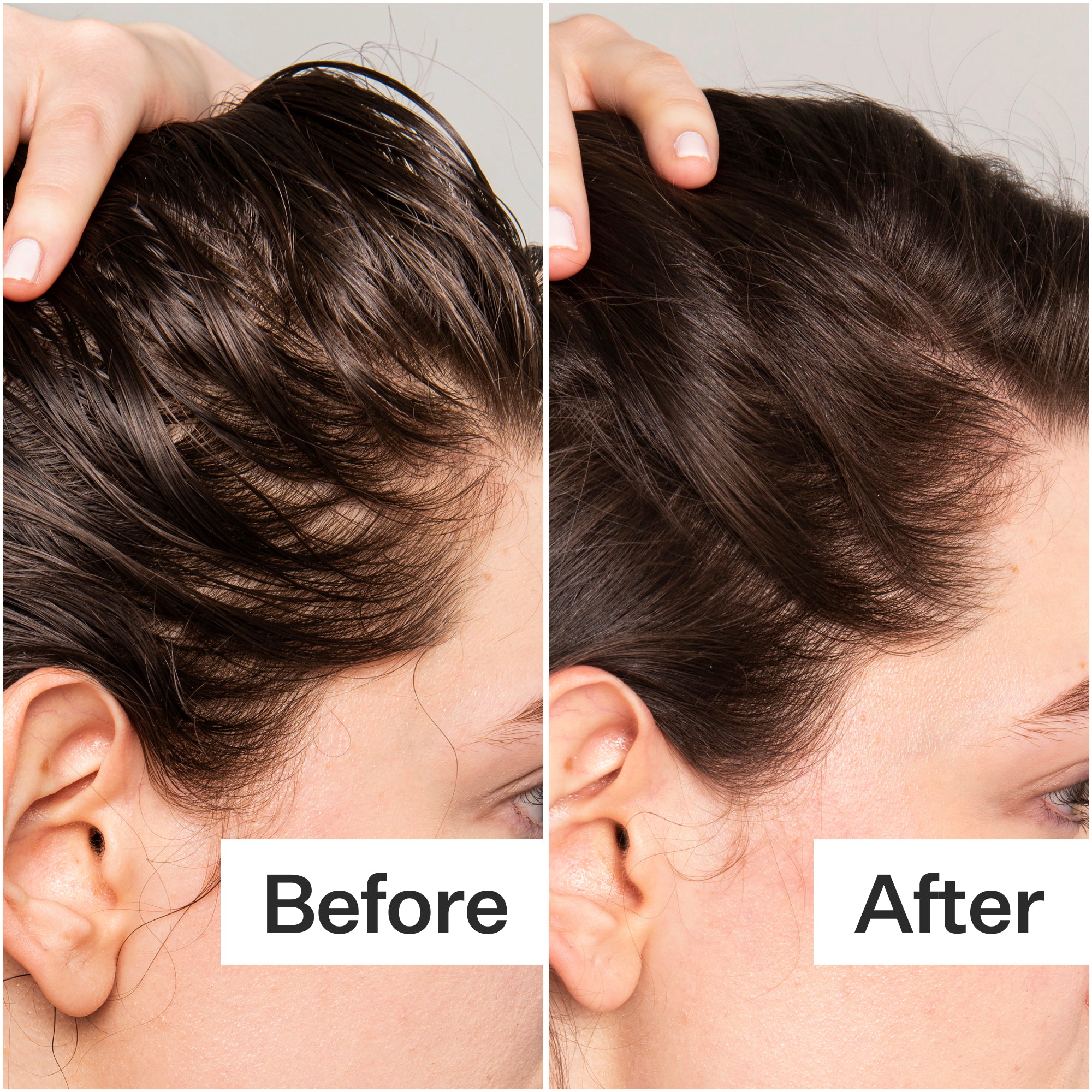 Side-by-side comparison of hair before and after treatment, showing improved volume and appearance. Text labels indicate "Before" and "After."