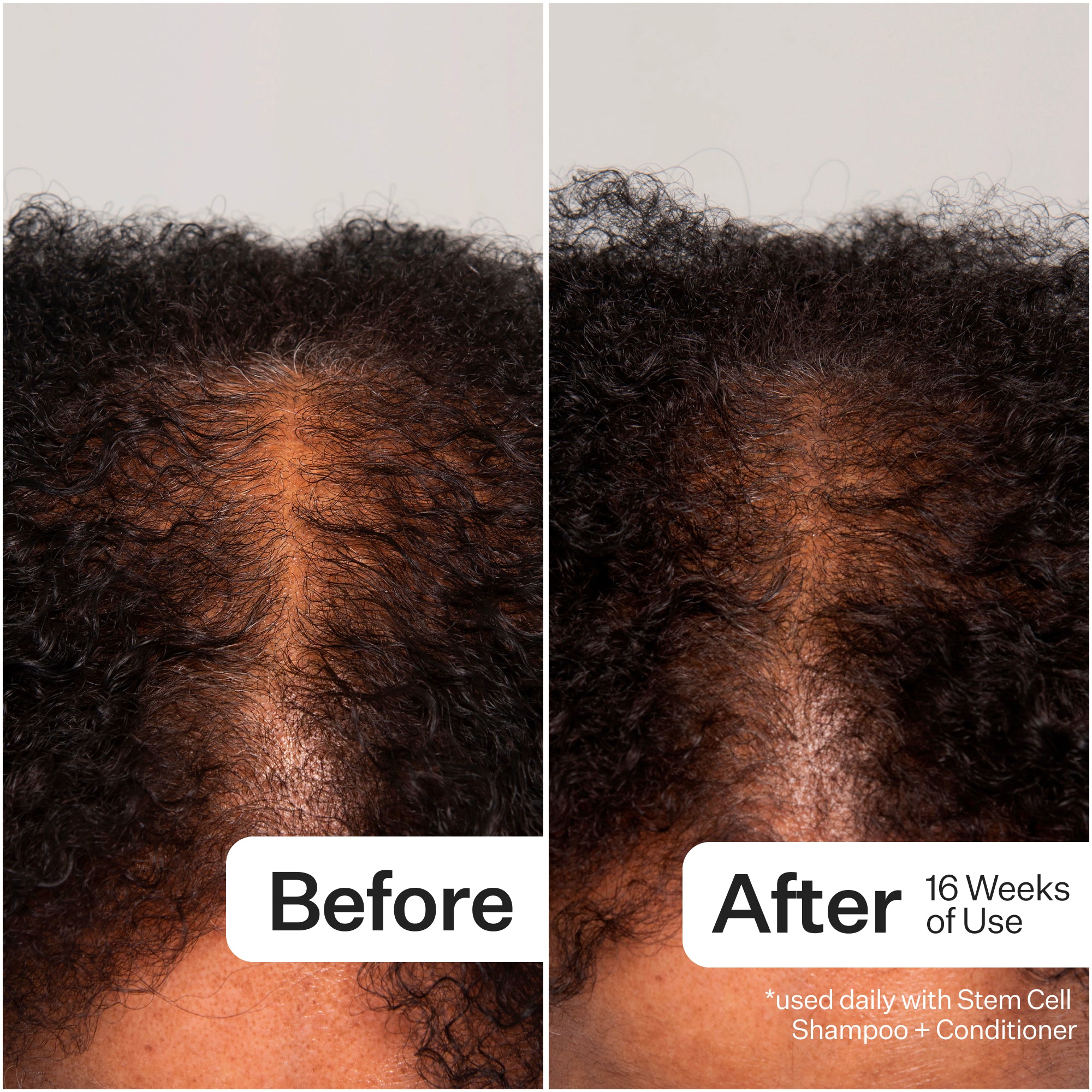 Side-by-side comparison of hair before and after 16 weeks of using a stem cell shampoo and conditioner.