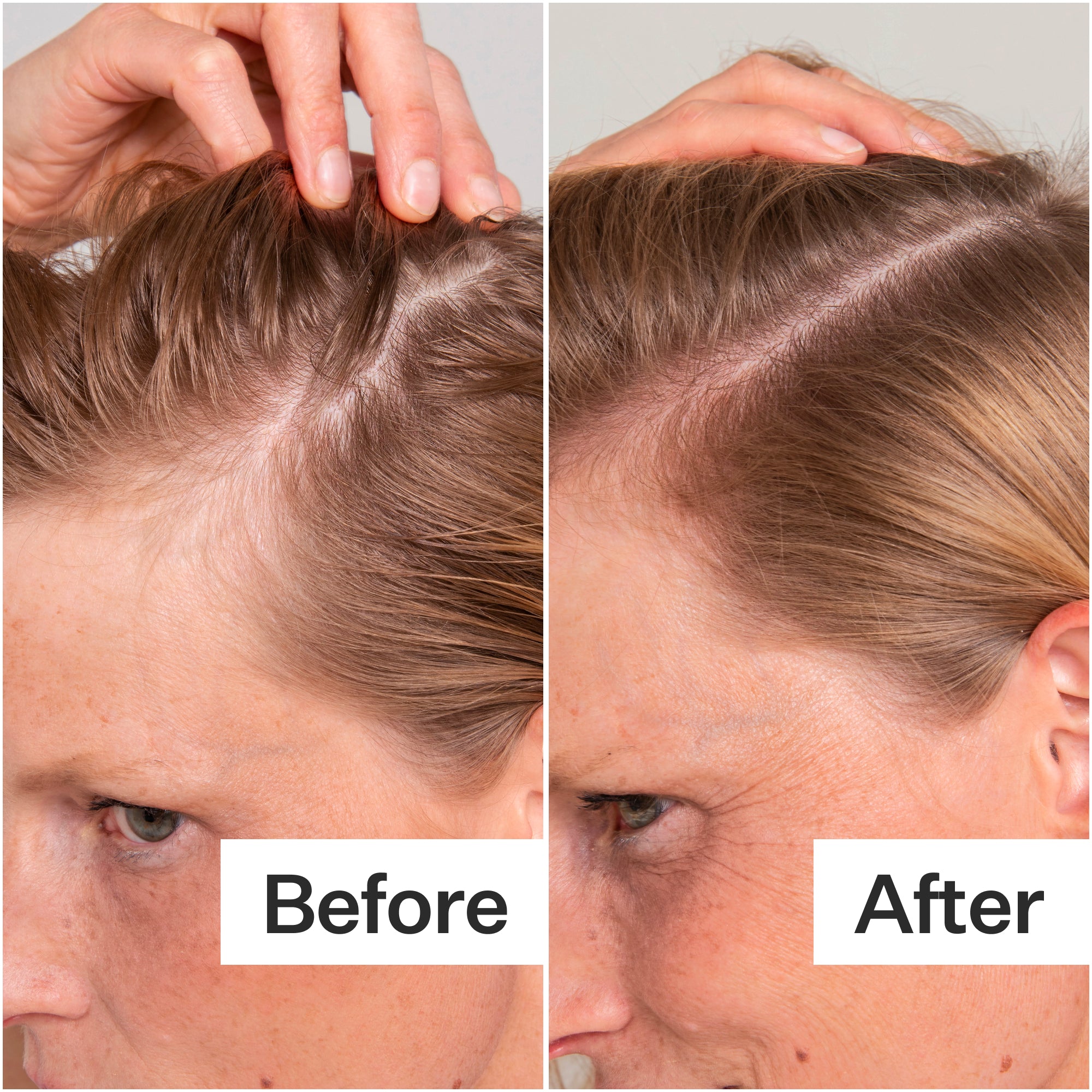 Side-by-side comparison of hair before and after treatment, showing improved thickness and coverage. Labels indicate "Before" and "After."