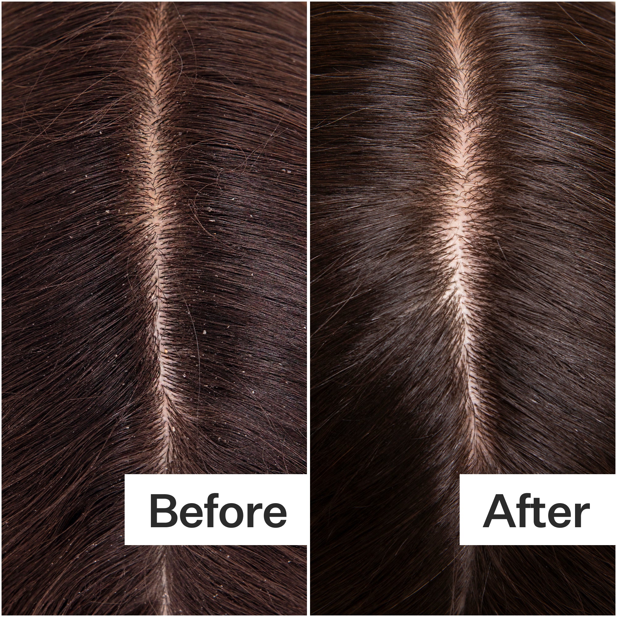 Side-by-side comparison of hair before and after treatment, showing improved appearance and reduced flakes.