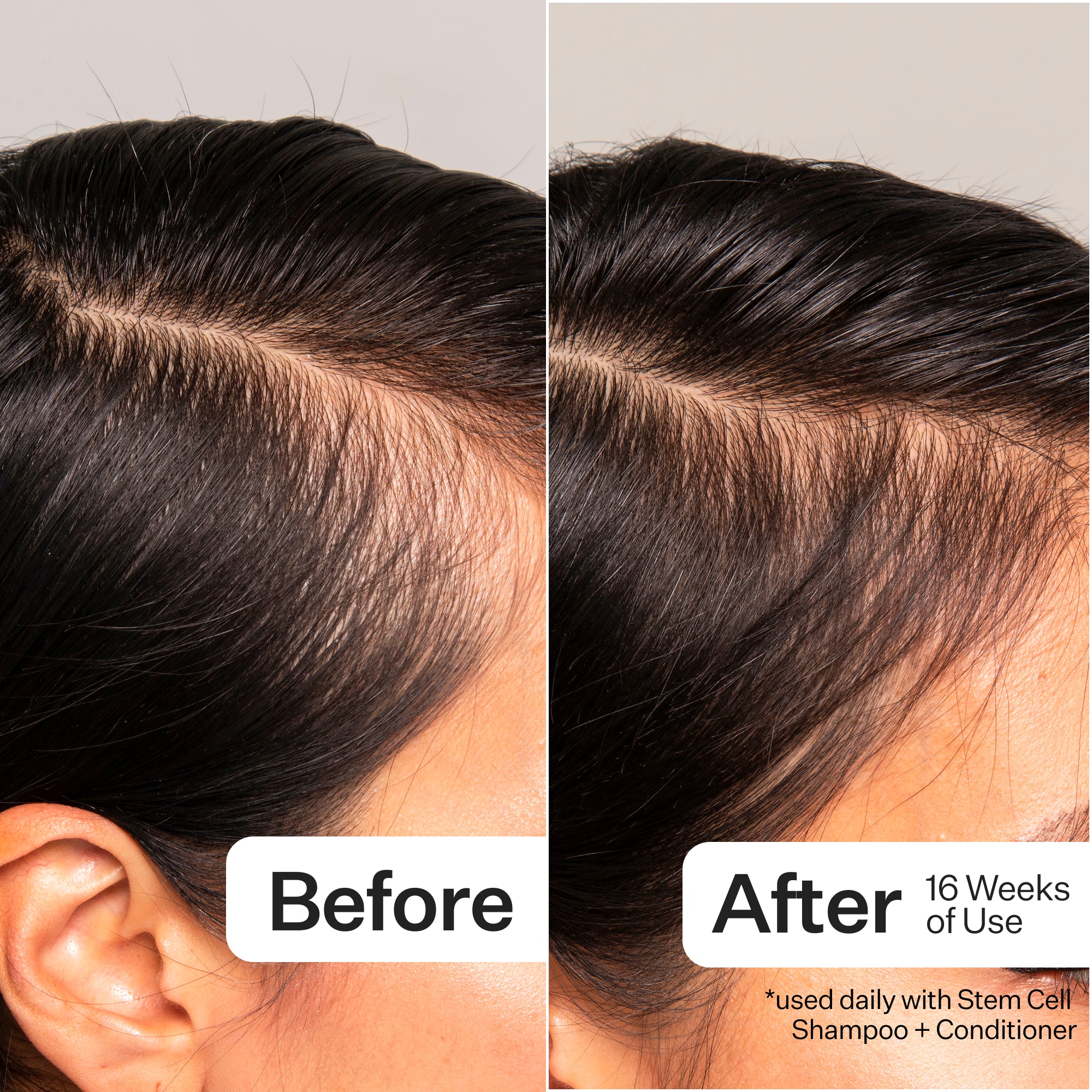 Side-by-side comparison of hair before and after 16 weeks of using a stem cell shampoo and conditioner.
