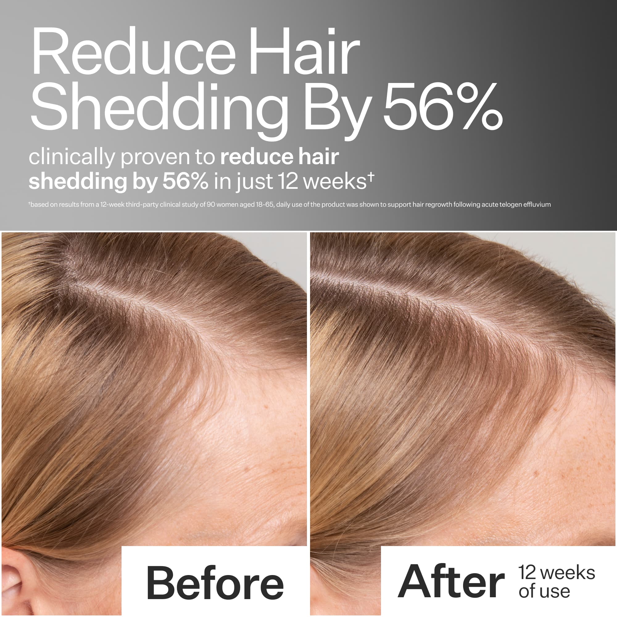 Before and after comparison of hair shedding reduction with text indicating 56% reduction clinically proven.